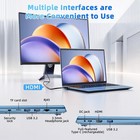 15 6   Laptop Computer with Windows 11 Pro 16GB RAM 1024GB SSD Office 365 WiFi 6