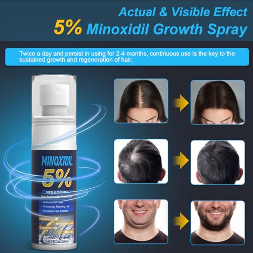 5  Minoxidil for Men and Women  Hair Growth Biotin Serum with Batana and Rosemary for Hair beard Regrowth Treatments  Extra Strength Hair Loss Solution to Regrow Thicker  2 02FL OZ