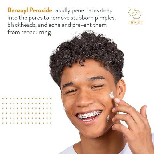 AcneFree Terminator 10 Acne Spot Treatment with Benzoyl Peroxide 10  Maximum Strength Acne Cream Treatment  1 Ounce   Pack Of 1