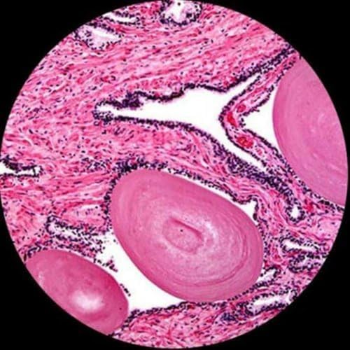 AmScope Microscopio binocular compuesto B490B-LED, oculares WF10x y WF20x, aumento 40X-2000X, Brightfield, iluminación LED, condensador Abbe, etapa mecánica de doble capa, cabezal deslizante, óptica