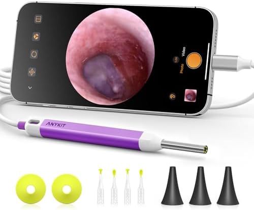 Anykit Digital Otoscope with Gyroscope  HD Ultra Clear View Ear Camera with Ear Wax Removal Tools  Video Ear Scope Otoscope with Light  Compatible with Android  iPhone 15  Purple 