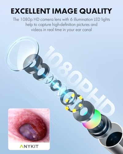 Anykit Digital Otoscope with Gyroscope  HD Ultra Clear View Ear Camera with Ear Wax Removal Tools  Video Ear Scope Otoscope with Light  Compatible with Android  iPhone 15  Purple 