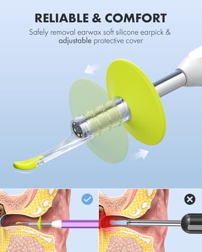Anykit Digital Otoscope with Gyroscope  HD Ultra Clear View Ear Camera with Ear Wax Removal Tools  Video Ear Scope Otoscope with Light  Compatible with Android  iPhone 15  Purple 
