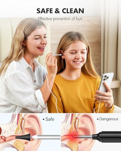 Anykit Digital Otoscope with Gyroscope  HD Ultra Clear View Ear Camera with Ear Wax Removal Tools  Video Ear Scope Otoscope with Light  Compatible with Android  iPhone 15  Purple 