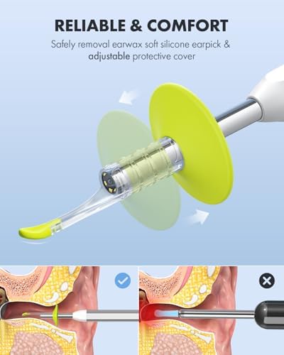 Anykit Digital Otoscope with Gyroscope  HD Ultra Clear View Ear Camera with Ear Wax Removal Tools  Video Ear Scope Otoscope with Light  Compatible with Android  iPhone 15  Purple 