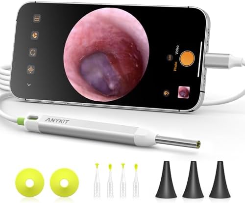 Anykit Digital Otoscope with Gyroscope  HD Ultra Clear View Ear Camera with Ear Wax Removal Tools  Video Ear Scope Otoscope with Light  Compatible with Android  iPhone 15  Purple 