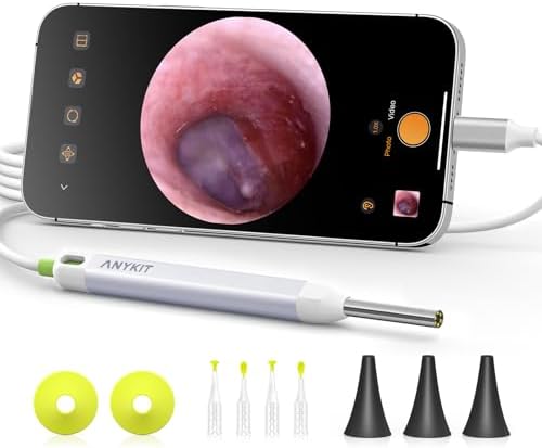 Anykit Digital Otoscope with Gyroscope  HD Ultra Clear View Ear Camera with Ear Wax Removal Tools  Video Ear Scope Otoscope with Light  Compatible with Android  iPhone 15  Purple 