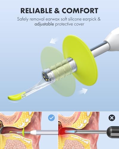 Anykit Digital Otoscope with Gyroscope  HD Ultra Clear View Ear Camera with Ear Wax Removal Tools  Video Ear Scope Otoscope with Light  Compatible with Android  iPhone 15  Purple 