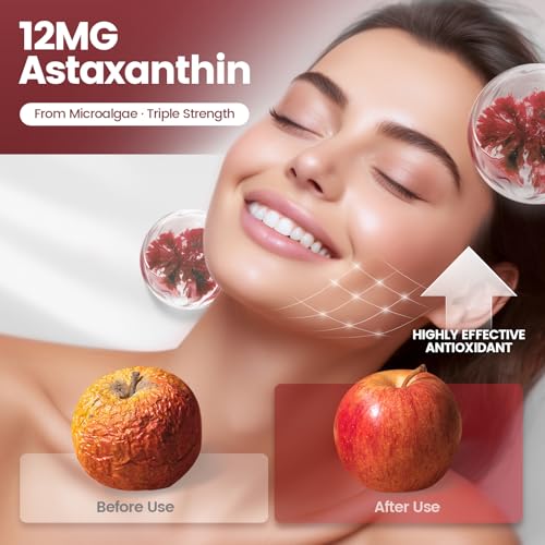 Astaxantina 12 mg, 960 cápsulas blandas, Haematococcus Pluvialis 10 en 1 suplementos antioxidantes de astaxantina, contiene licopeno, semilla de uva, vitamina E, apoya la salud de la piel de