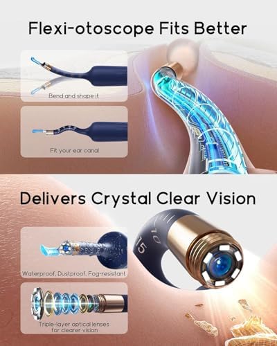 Bebird Earsight Plus D39R Ear Wax Removal Tool Camera  FSA HSA Eligible Items  Ear Cleaner with Flexible Ear Camera Otoscope  Visual Ear Pick Tweezers Wax Remover  Ear Cleaning Kit for Family