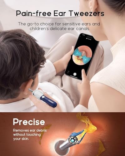 Bebird Earsight Plus D39R Ear Wax Removal Tool Camera  FSA HSA Eligible Items  Ear Cleaner with Flexible Ear Camera Otoscope  Visual Ear Pick Tweezers Wax Remover  Ear Cleaning Kit for Family