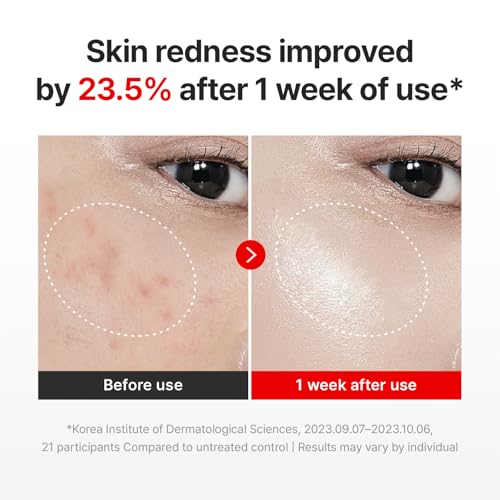 CENTELLIAN 24 Madeca Cream Time Reverse  50ml/1 69fl oz  Pack of 2  Advanced Fast Absorbing & Nourishing Cream  Hydrates  Reduces Wrinkles  Korean Skin Care  Centella Asiatica