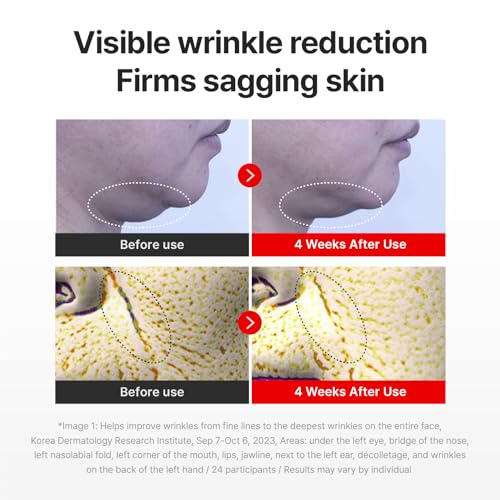 CENTELLIAN 24 Madeca Cream Time Reverse  50ml/1 69fl oz  Pack of 2  Advanced Fast Absorbing & Nourishing Cream  Hydrates  Reduces Wrinkles  Korean Skin Care  Centella Asiatica