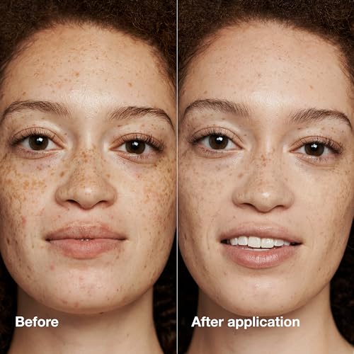 Clinique Even Better Makeup Liquid Foundation SPF 15 With Vitamin C For Dry   Oily Combination Skin Types   Medium Coverage   Natural Finish   Evens Skin Tone   Reduces Dark Spots
