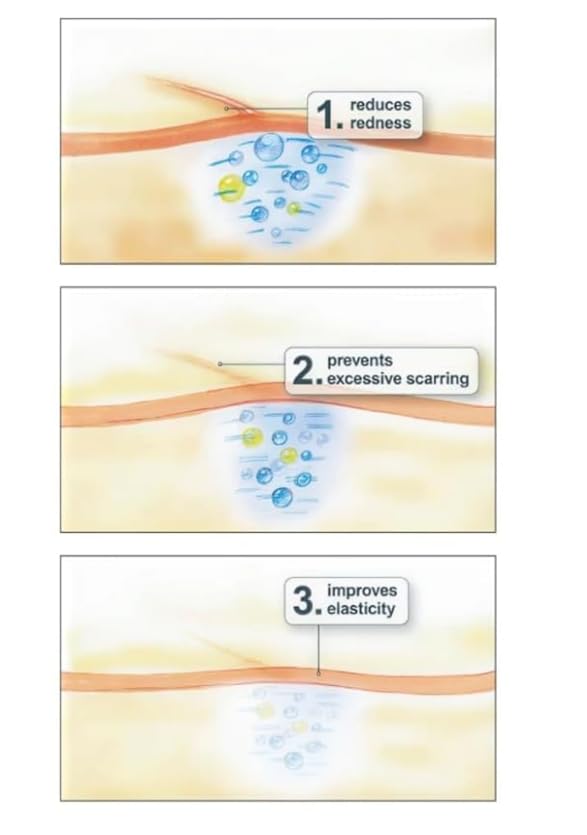 Contra ctube x 120g Gel   For Burns Tattoo Surgery Scars   German Brand   English Leaflet