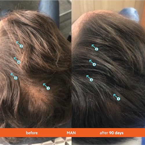 DS Labs Revita Shampoo & Spectral Men s Serum Kit   Scalp First Cleanse & Lightweight Leave In for Fuller Looking  Thicker Looking Hair  Sulfate & Silicone Free Shampoo  Fast Absorbing Serum