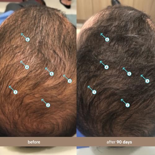 DS Labs Spectral Men s Hair Density Serum  formerly Spectral DNC N    Lightweight Leave In for Fuller Looking  Thicker Looking Hair  Fast Absorbing  Non Greasy  For All Hair Types  60mL