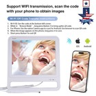 Dental Intra Oral Camera Wireless Dental with 17inch Screen Monitor Holder