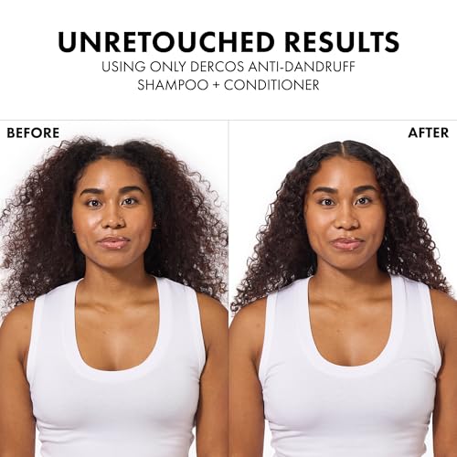 Dercos Dandruff Shampoo  Antifungal Dry Scalp Treatment & Itchy Scalp Relief  Prescription Strength Selenium Sulfide Comparable to 2  Ketoconazole  For Mild to Severe Dandruff & Flaky Scalps