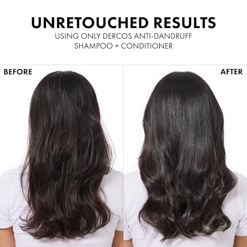 Dercos Dandruff Shampoo  Antifungal Dry Scalp Treatment & Itchy Scalp Relief  Prescription Strength Selenium Sulfide Comparable to 2  Ketoconazole  For Mild to Severe Dandruff & Flaky Scalps