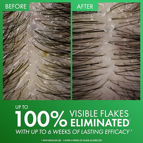 Dercos Dandruff Shampoo  Antifungal Dry Scalp Treatment & Itchy Scalp Relief  Prescription Strength Selenium Sulfide Comparable to 2  Ketoconazole  For Mild to Severe Dandruff & Flaky Scalps