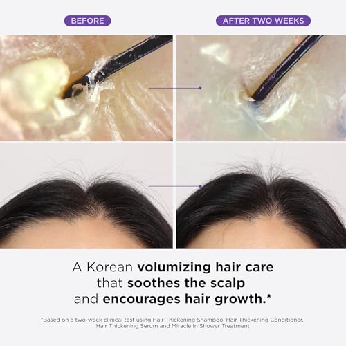 Dr  Groot Thickening Serum  Shampoo  Conditioner  and Scalp Treatment Set for Hair Loss   Clinical Results with Biotin and Rosemary for Hair Thinning  Shedding  Scalp Repair and Treatment