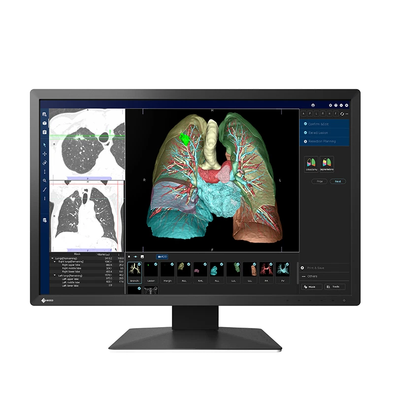 EIZO RadiForce MX243W Medical 24 1" Widescreen LCD Display Monitor 2 3MP   NEW