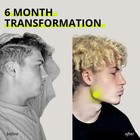 JAWLINER  3 0   Elite Edition  Bundle Pack