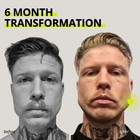 JAWLINER  3 0   Elite Edition  Bundle Pack