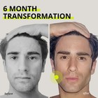 JAWLINER  3 0   Elite Edition  Bundle Pack