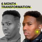 JAWLINER  3 0   Elite Edition  Bundle Pack