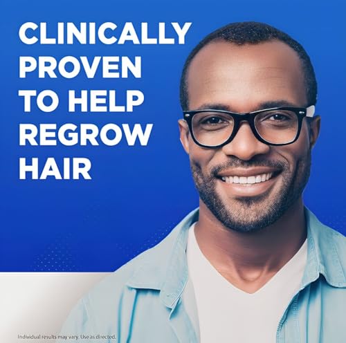 Kirkland Minoxidil 5% para hombres, solución tópica de fuerza extra para el tratamiento del crecimiento del cabello, suministro para 6 meses, total 355 ml, aplicador con gotero, incluye 2 paños de