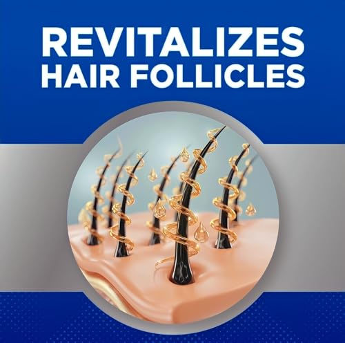 Kirkland Minoxidil 5% para hombres, solución tópica de fuerza extra para el tratamiento del crecimiento del cabello, suministro para 6 meses, total 355 ml, aplicador con gotero, incluye 2 paños de