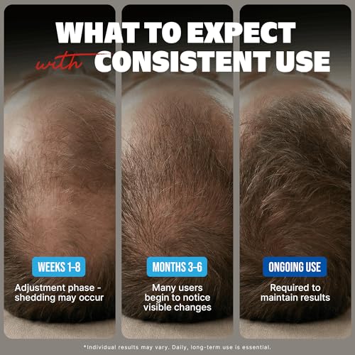 Kirkland Tratamiento exclusivo para el crecimiento del cabello extra fuerte para hombres, solución tópica de minoxidil al 5%, 2 onzas líquidas, paquete de 6