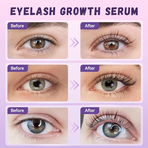 Lash Serum Natural & Vegan Eyelash Growth Serum for Longer  Thicker  Fuller Lashes Nourishing & Conditioning Formula Safe for Sensitive Eyes   5ml