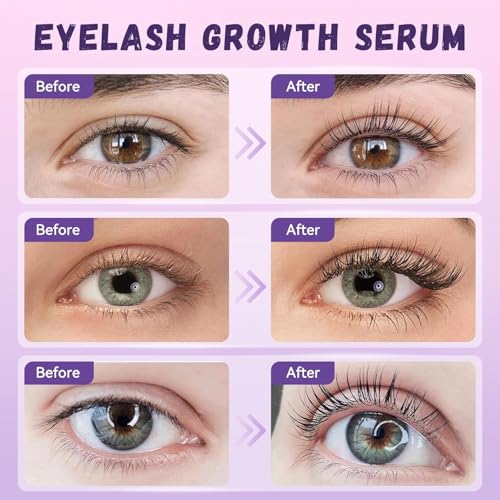 Lash Serum  Natural & Vegan Eyelash Growth Serum for Longer  Thicker  Fuller Lashes Nourishing & Conditioning Formula Safe for Sensitive Eyes   5ml