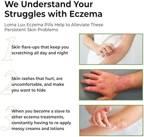 Loma Lux Eczema Pills   Natural Eczema Treatment Relief Remedy   Dermatologist Developed   7 Minerals Clear & Prevent Severe Eczema Scaling  Rash  Anti Itch Skin Body Face for Adults  Kids  Toddlers