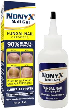 NONYX Fungal Nail Clarifying Gel   Clinically Proven for Discolored  Thick  Brittle  Yellow  Lifted  and other signs of Fungus Damaged Toenails   90  of Nails Improve   Over 8 million sold
