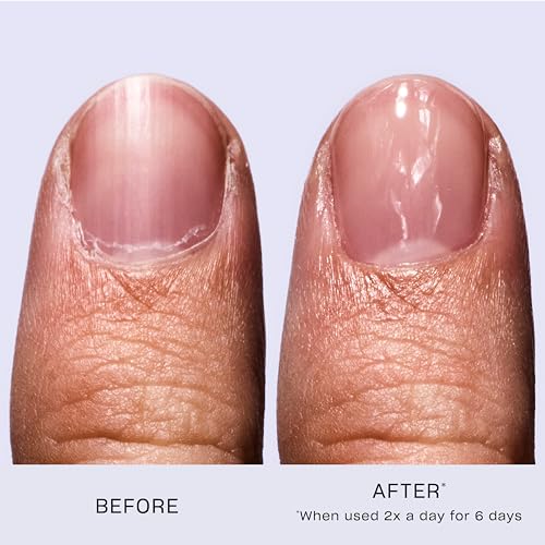 OPI Nail Envy, tratamiento de fortalecimiento de uñas, uñas más fuertes en 1 semana, fórmula vegana, 0.5 onzas líquidas