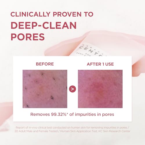 SKIN1004 Poremizing Deep Cleansing Foam  4 23 fl oz  125ml  Makeup Remover  Korean Face Cleanser with Himalayan Pink Salt & Madagascar Centella Asiatica for Facial Pore Cleansing  Korean Skin Care