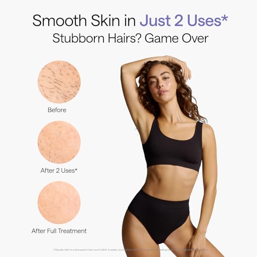 Ulike Dispositivo de depilación láser Air 10 Ipl regalo para mujeres y hombres, reducción permanente del vello frío y permanente para casi sin dolor, luces duales, sensor de piel y depilación en modo USHR en 10 minutos desde casa