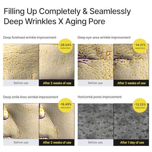 celimax The Vita A Retinal Shot Tightening Booster   0 1  Retinal  3  Matryxyl  High Strength Retinoid for Anti Aging  Pore Minimizer  Wrinkles & Fine Lines  Firmer Skin  15ml