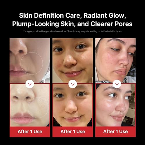medicube Booster Pro   6 in 1 Real Glass Glow Beauty Massager   for Clear  Radiant  Firmer Looking Skin   Korean Skin Care   Black