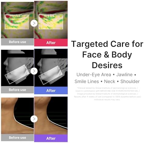 medicube Mini Booster Pro Plus Face Roller Device Set   2 in 1 Massage & Skincare Device   Jawline Care & Depuffing   Face & Body Massager with 3 Vibration Modes   Korean Facial Device  Pink